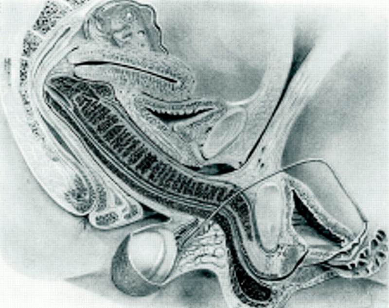 Coitus serendipitus