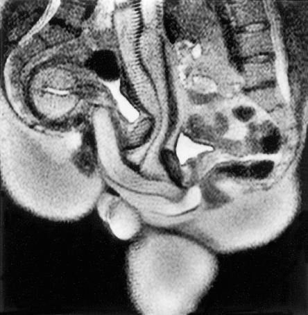‘Ik maakte als eerste een MRI-scan van de coïtus. Eerst vroeg ik het aan mijn vrouw, maar zij wilde niet, vanwege een lichte vorm van claustrofobie.'
